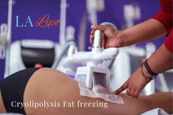women getting fat freezing Haverhill