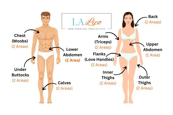 LA LIPO Cryolipolysis Areas Haverhill