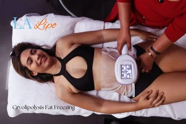 woman getting cryolipolysis Haverhill