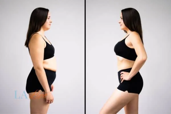 link between body image and mental health Haverhill