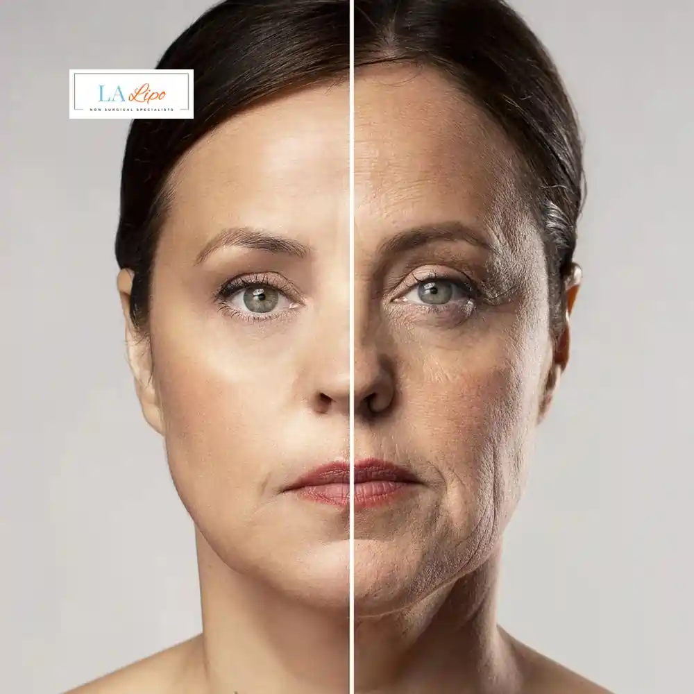 How Can You Tell If Non-Surgical Skin Tightening Is Right for You Haverhill?