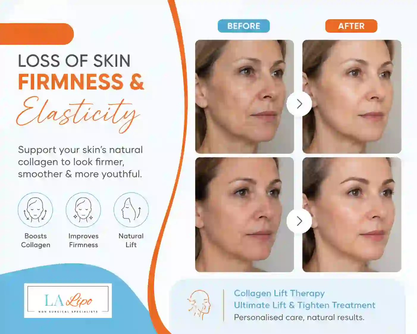 Sign #7: Loss of Skin Firmness and Elasticity Haverhill